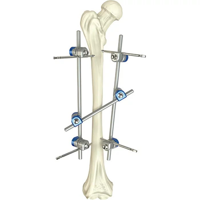 A qualidade assegurou instrumentos médicos cirúrgicos médicos externos de Fixator do eixo femoral ortopédico básico do instrumento cirúrgico