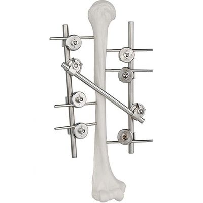 Implante cirúrgico ortopédico externo Humeral do dispositivo de fixação do titânio