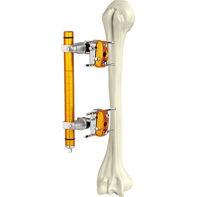 Eixo Humeral ortopédico médico Fixator externo dos instrumentos cirúrgicos
