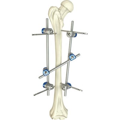 O instrumento ortopédico básico ajustou o dispositivo de fixação externo do eixo femoral cirúrgico