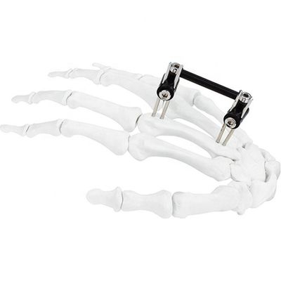 Dispositivo cirúrgico ortopédico de Mini Fragment Ilizarov External Fixation