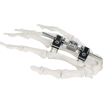 Dispositivo cirúrgico ortopédico de Mini Fragment Ilizarov External Fixation