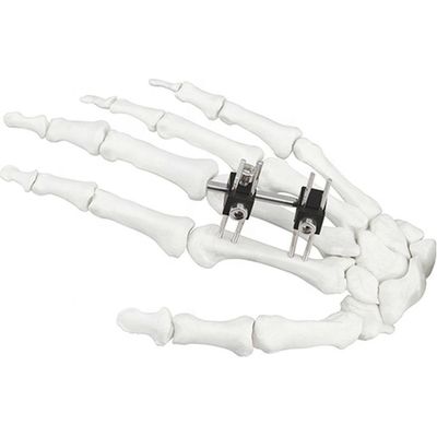 Dispositivo cirúrgico ortopédico de Mini Fragment Ilizarov External Fixation