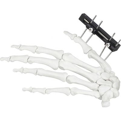 Dispositivo cirúrgico ortopédico de Mini Fragment Ilizarov External Fixation