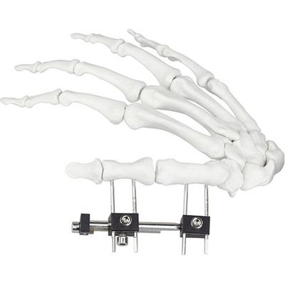 Dispositivo cirúrgico ortopédico de Mini Fragment Ilizarov External Fixation