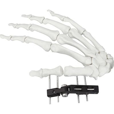 Dispositivo cirúrgico ortopédico de Mini Fragment Ilizarov External Fixation
