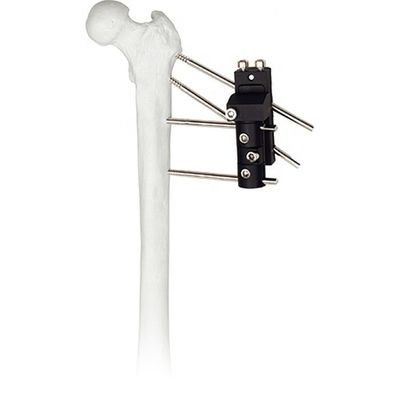 A imagem maior do vídeo-iconimage da imagem da vista adiciona à articulação da bacia ortopédica de instrumentos cirúrgicos do preço competitivo de CompareShare