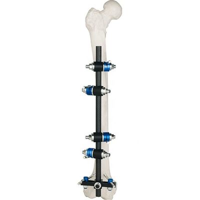 Dispositivo de fixação externo Condylar