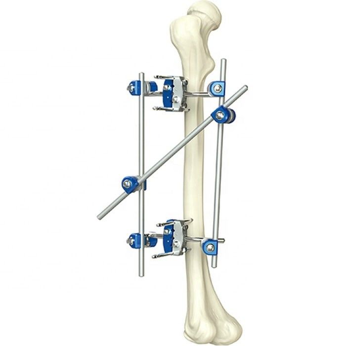 Tíbia ortopédica do instrumento excelente da qualidade & instrumentos cirúrgicos ortopédicos externos de Percone Fixator