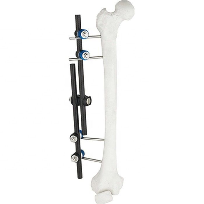Instrumentos cirúrgicos ortopédicos da venda quente Tibial & da fixação externo externo de Fixator AO do fêmur instrumento ortopédico